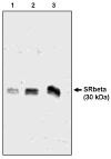 "Western blot analysis
using SRβ antibody
(Cat. No. Z115P) on 3 (1), 6 (2) and 12 (3) ng of canine microsomal
protein"